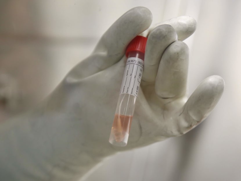 New Covid-19 test kit deployed at all S’pore checkpoints detects its first imported case New Covid-19 test kit deployed at all S’pore checkpoints detects its first imported case