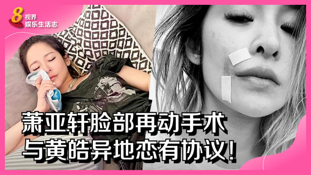 萧亚轩脸部再动手术　与黄皓异地恋有协议！