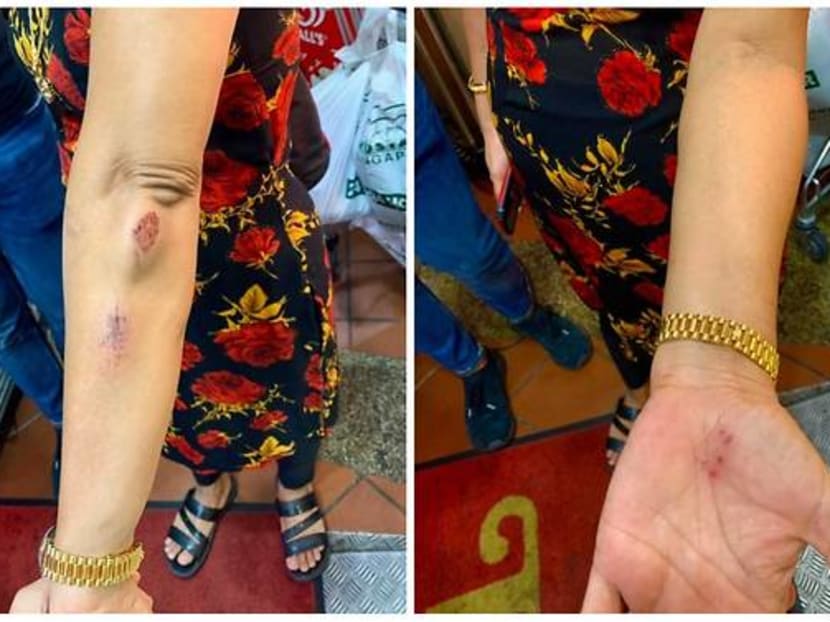 Madam Hindocha Nita Vishnubhai sustained injuries on her arms and hands after a man allegedly attacked her on May 7, 2021.