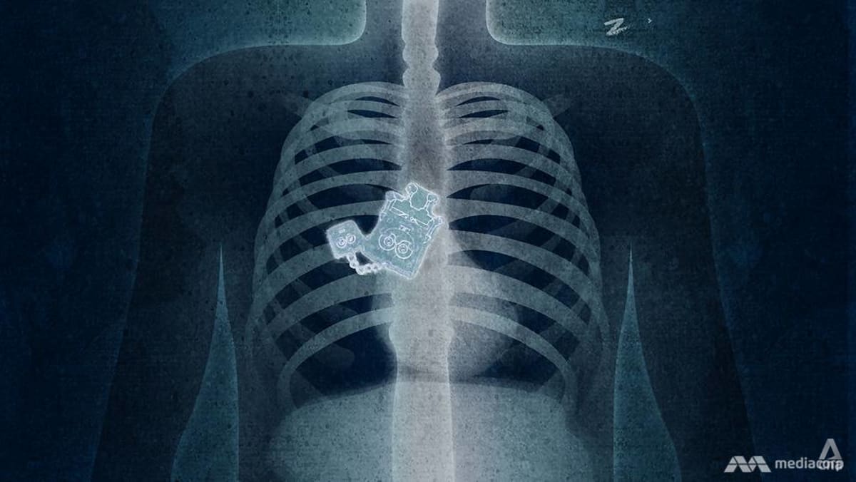 What to do when you've swallowed something you shouldn't have - CNA Lifestyle What to do when you've swallowed something you shouldn't have - CNA Lifestyle