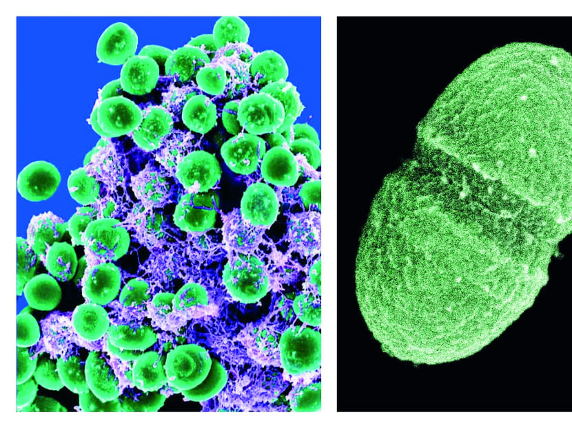 Staphylococcus epidermidis bacteria (left, in green) in the extracellular matrix, which connects cells and tissue, and the Enterococcus faecalis, which lives in the human gut. Trillions of microbes teem inside and on the surface of the human body. Photo: AP