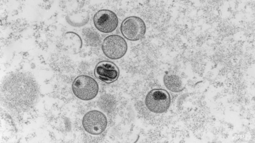 Monkeypox cases will be given isolation orders and can recover at home from Aug 22: MOH Monkeypox cases will be given isolation orders and can recover at home from Aug 22: MOH