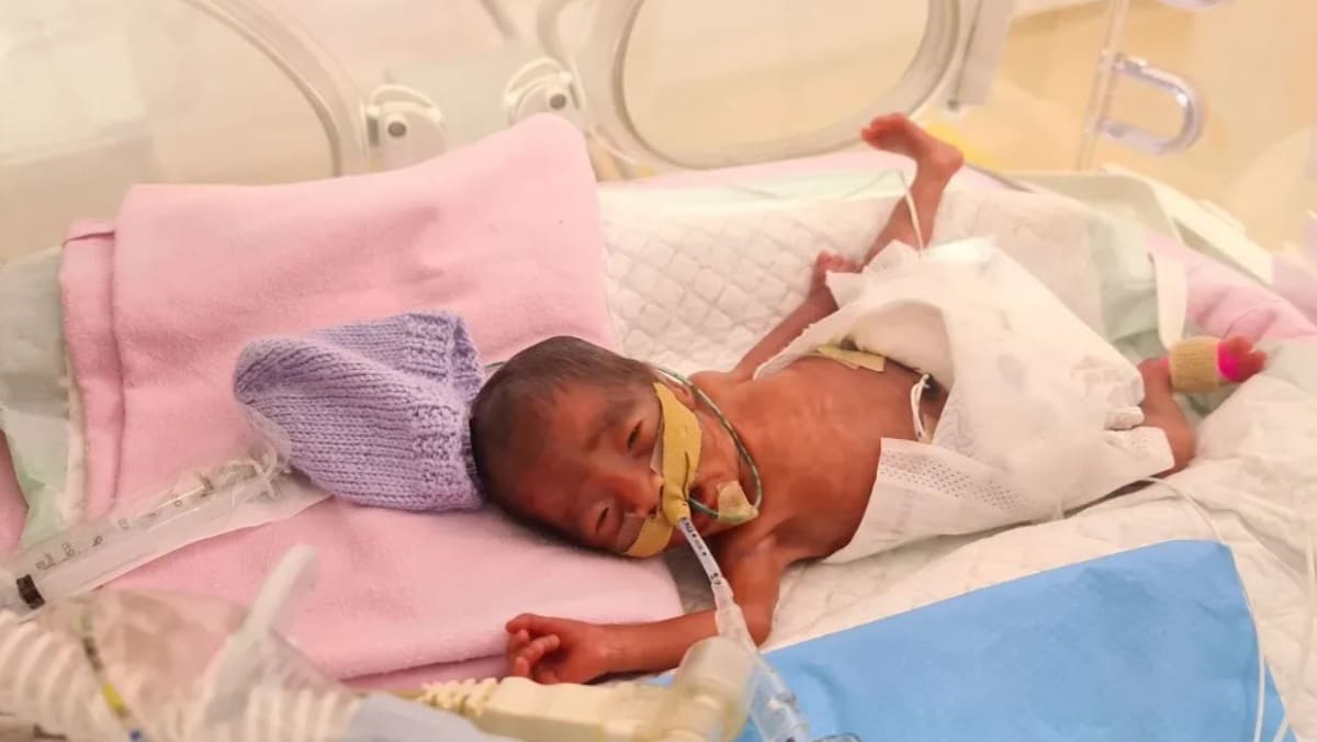 29 week premature baby sales