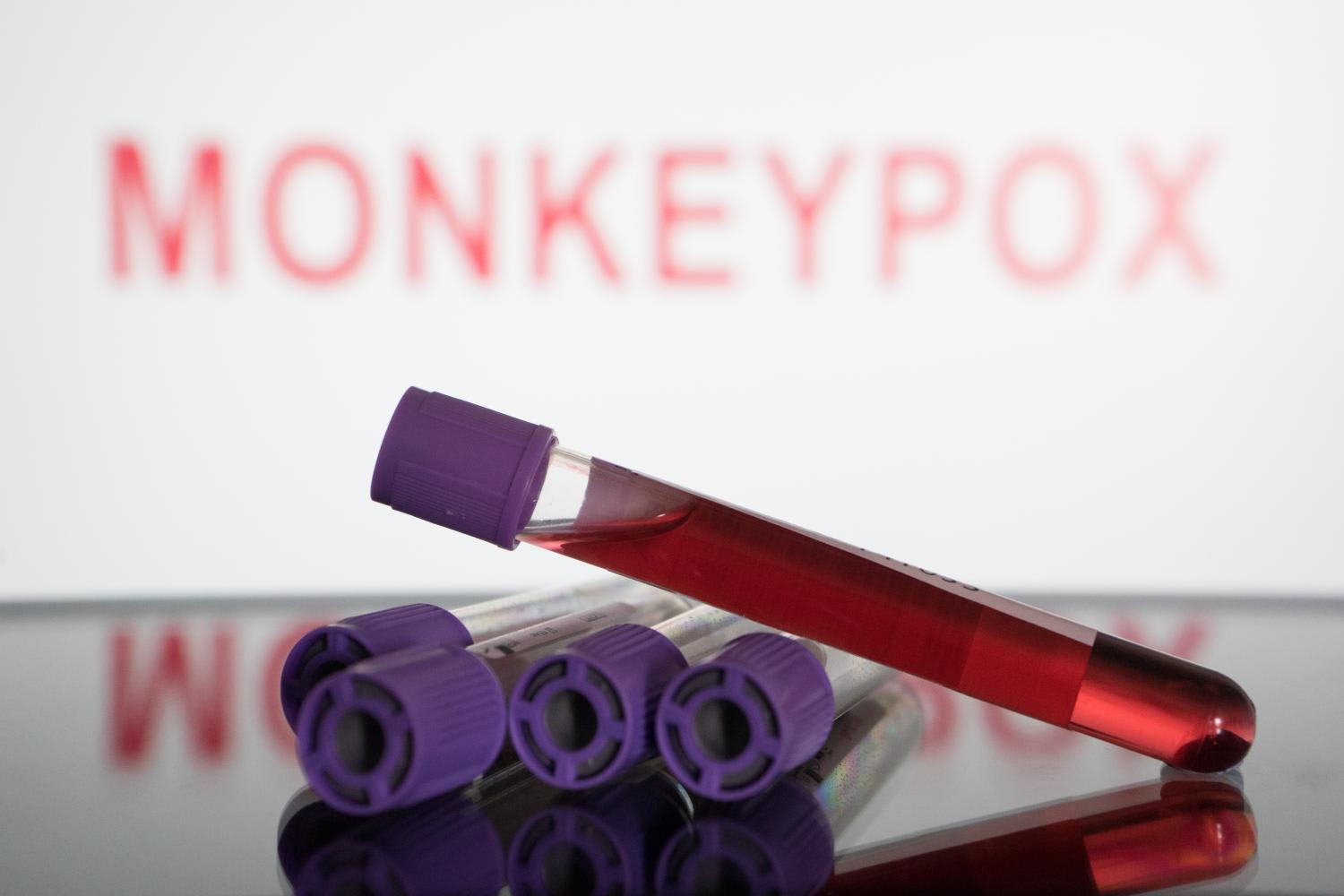 Explainer: What's the global monkeypox situation ahead of WHO decision on whether to declare public health emergency Explainer: What's the global monkeypox situation ahead of WHO decision on whether to declare public health emergency