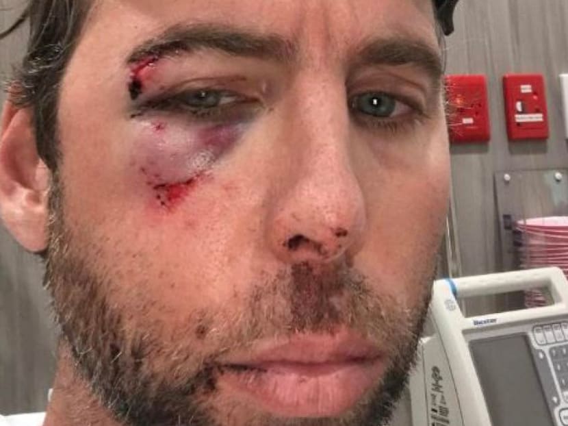 Grant Hackett posted this photo of himself on his Instagram account when he checked into hospital last week. He said his brother Craig had beaten him up. Photo: Grant Hackett's Instagram account