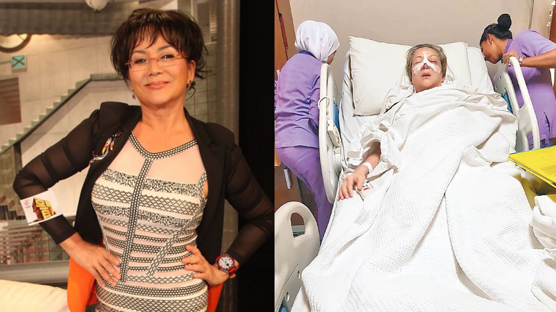 Veteran Hongkong Star Fung Bo Bo Got Into A Car Accident In Bangkok, Had Flown To Singapore To Fix Her Broken Nose Veteran Hongkong Star Fung Bo Bo Got Into A Car Accident In Bangkok, Had Flown To Singapore To Fix Her Broken Nose