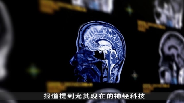 晨光|纸上风云：美国宣布新法案 保护大脑神经数据