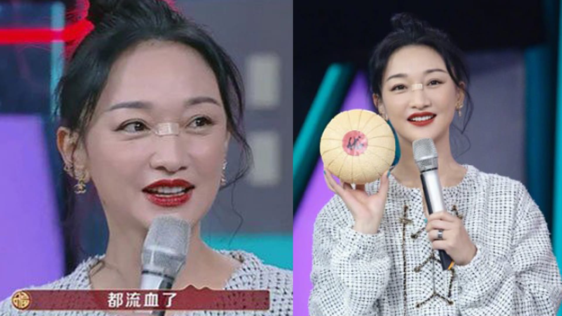 Zhou Xun Has A Cut On Her Nose Bridge ’Cos She Dropped Her Phone On Her Face While Playing With It In Bed