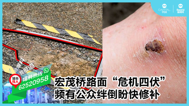 宏茂桥路面“危机四伏”  频有公众绊倒盼快修补