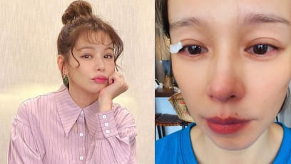 Vivian Hsu Thought She Had Nose Cancer After Looking Up Her Symptoms Online