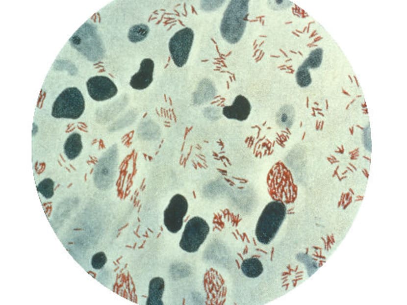 A photomicrograph of mycobacterium leprae taken from a leprosy skin lesion. Photo: A*STAR