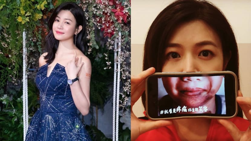Michelle Chen Was Raising Awareness For Abused Children But Got Slammed For Editing Her Photos Instead