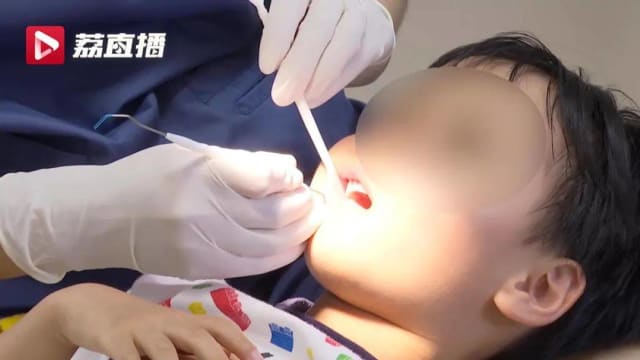 牙洞可用牙膏修复？中国女童牙洞没补成反损六颗牙