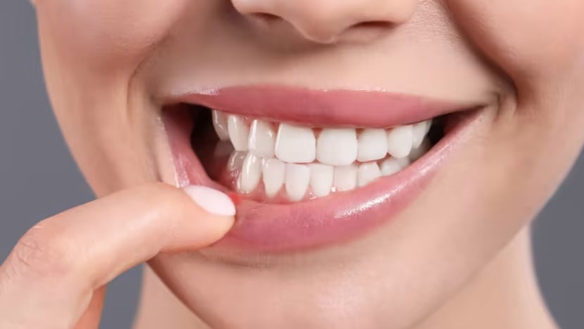 Adakah garam berkesan untuk rawat ulser mulut?