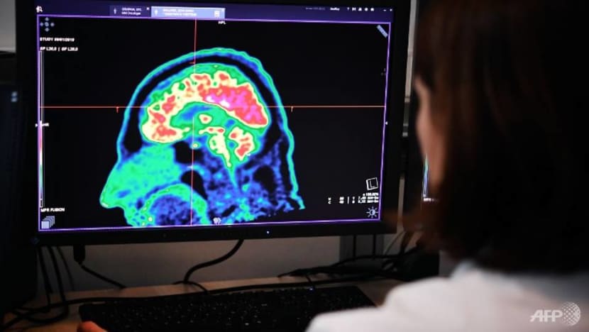 When every second counts: Using AI to assess brain injuries could save lives