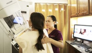 Commentary: Do earlier, annual mammograms save more lives?