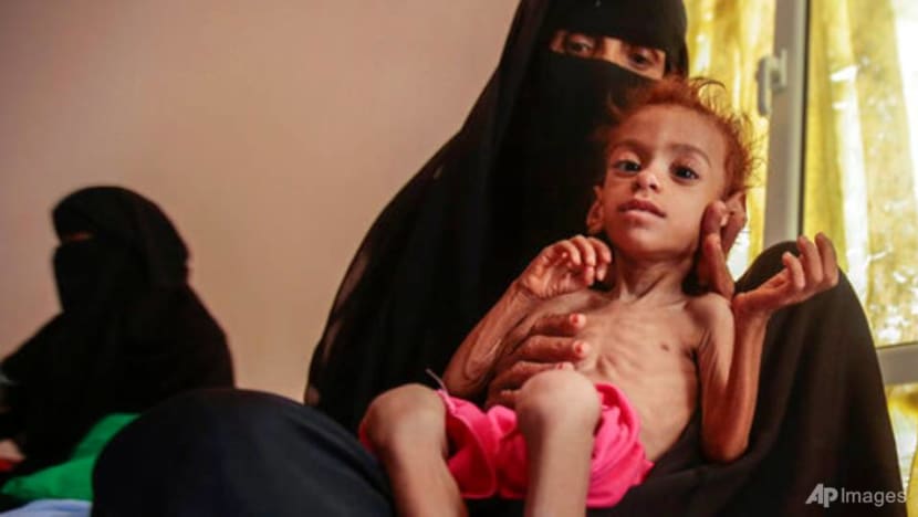 UN warns of mass famine in Yemen ahead of donor conference UN warns of mass famine in Yemen ahead of donor conference