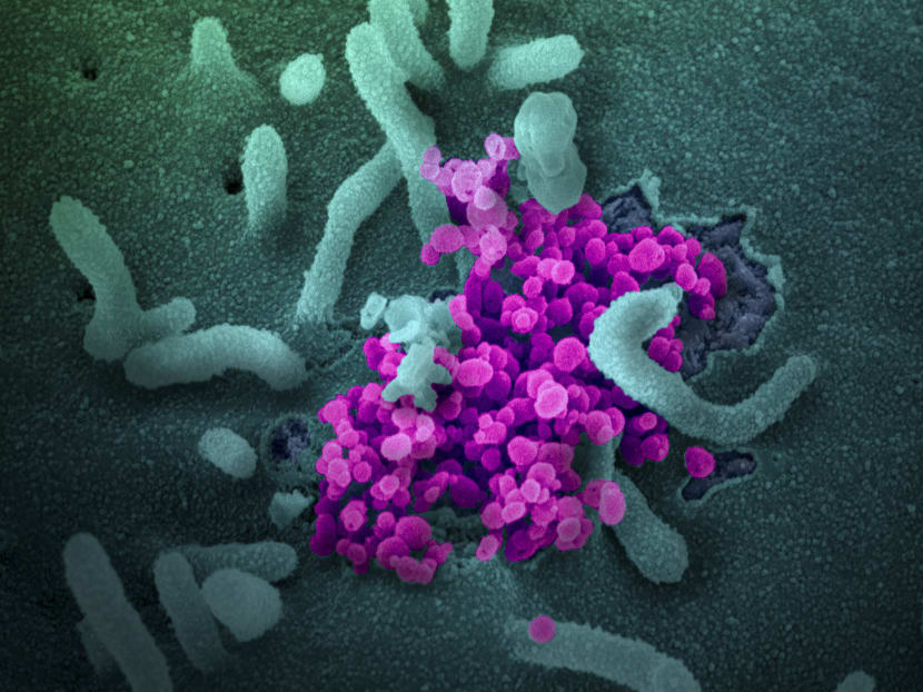 A scanning electron microscope image shows SARS-CoV-2 (round magenta objects) emerging from the surface of cells cultured in the lab.