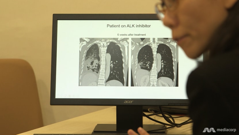 Better Odds in Fighting Lung Cancer Better Odds in Fighting Lung Cancer