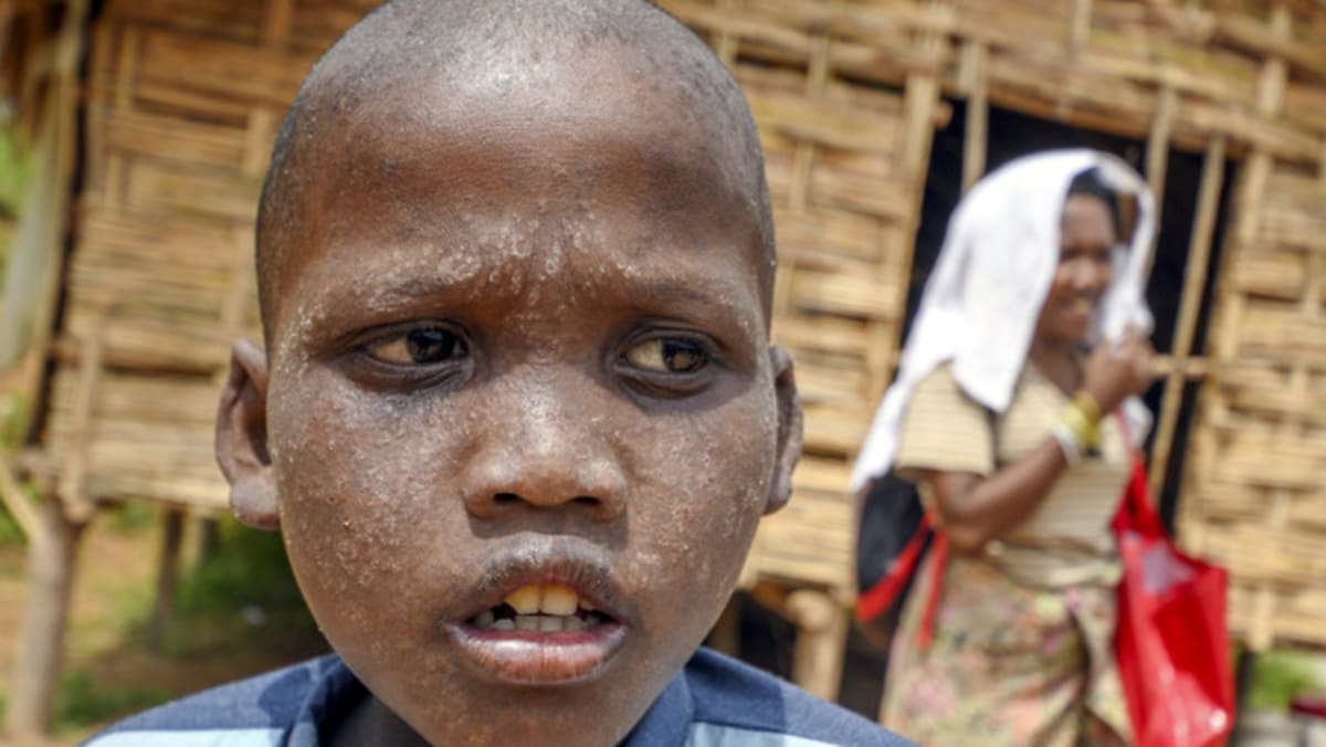 Kelantan Settlement Cordoned Off After Orang Asli Deaths Cause Of Illness Yet To Be Identified Cna