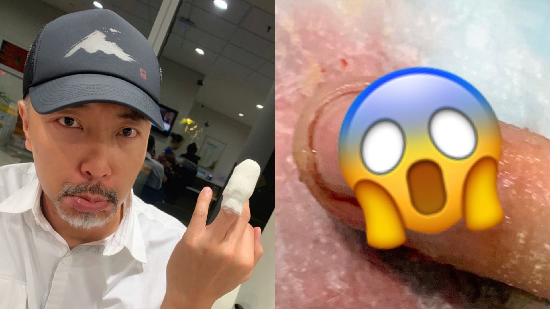Tay Ping Hui Crushed His Finger Real Badly On Set; Says The Pain Was A “Perfect 10” Tay Ping Hui Crushed His Finger Real Badly On Set; Says The Pain Was A “Perfect 10”