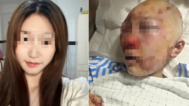 中国19岁女网红公厕遭虐殴挖眼拔舌 装死忍受凶手泄欲