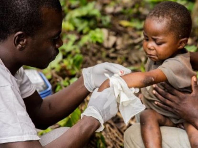 Commentary: Vigilance, not universal smallpox vaccination, needed against monkeypox