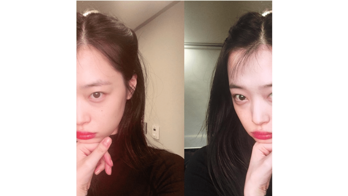 Sulli Reportedly Sent to ER After Sustaining Wrist Injury 8 Days