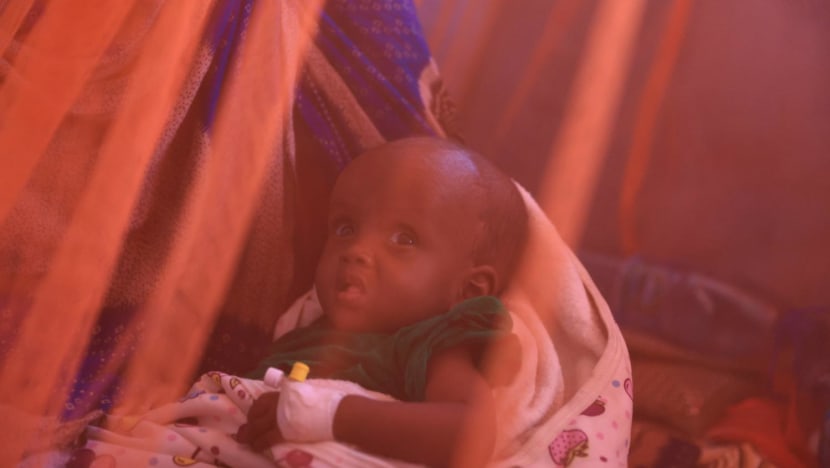Malnourished kids crowd hospital as Ethiopia hit by worst drought in 40 years Malnourished kids crowd hospital as Ethiopia hit by worst drought in 40 years