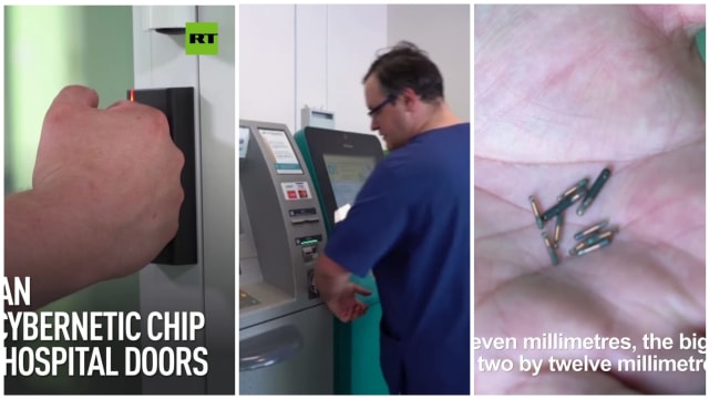 俄罗斯医生手植芯片 伸手即可解锁开门提款