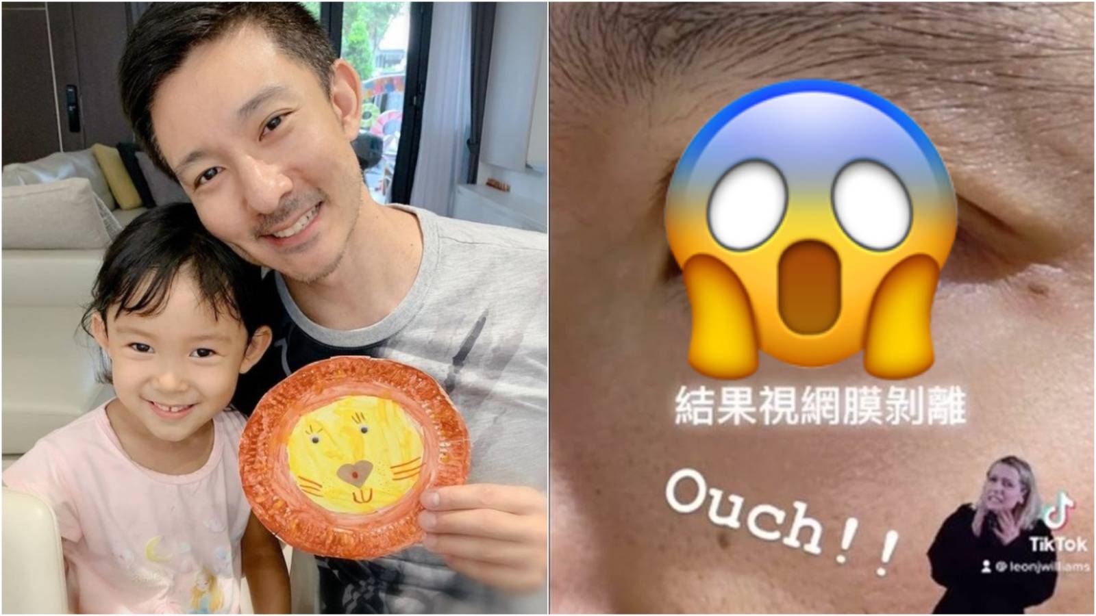 Leon Jay Williams Almost Went Blind After Getting Kicked In The Eye By His 6-Year-Old Daughter Leon Jay Williams Almost Went Blind After Getting Kicked In The Eye By His 6-Year-Old Daughter