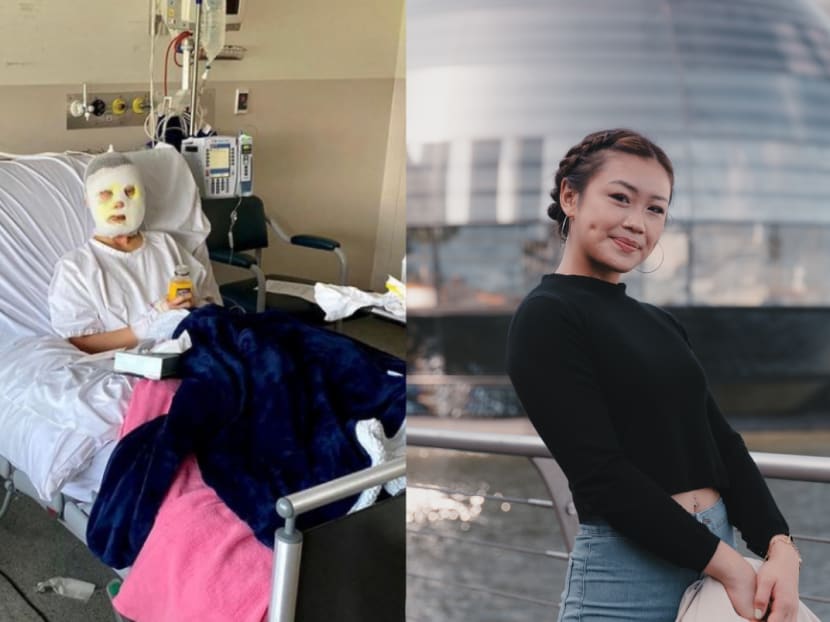 This Singaporean burn survivor is so inspiring a Kardashian called her a 'queen'