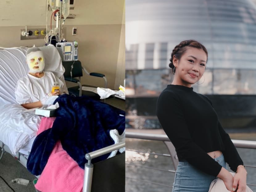 This Singaporean burn survivor is so inspiring a Kardashian called her a 'queen' This Singaporean burn survivor is so inspiring a Kardashian called her a 'queen'