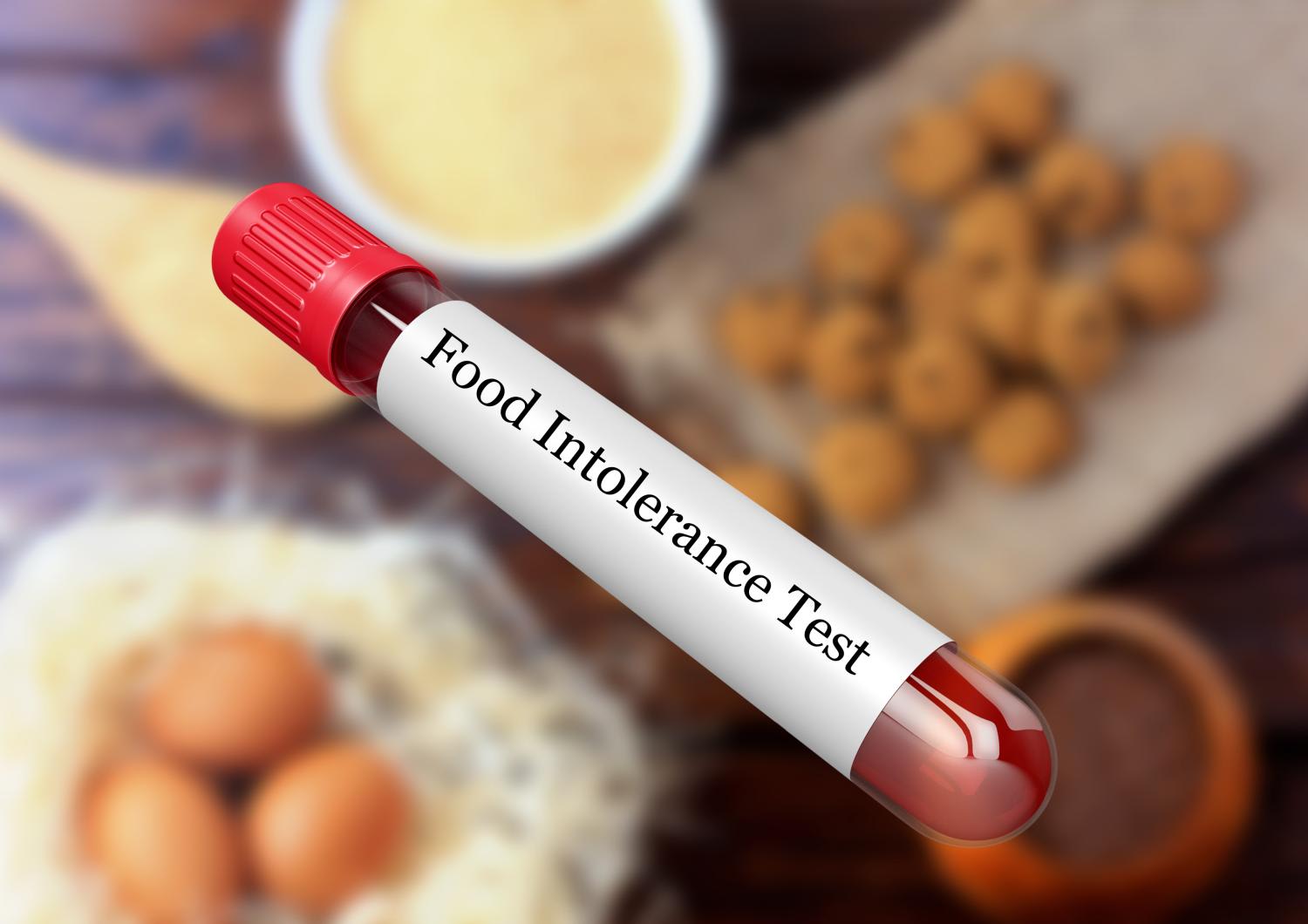 Food-sensitivity tests promise to supply answers. For decades, these tests were offered mainly in providers’ offices in alternative-medicine settings. Now, they are increasingly available as at-home tests you can purchase online or on drugstore shelves. Food-sensitivity tests promise to supply answers. For decades, these tests were offered mainly in providers’ offices in alternative-medicine settings. Now, they are increasingly available as at-home tests you can purchase online or on drugstore shelves.