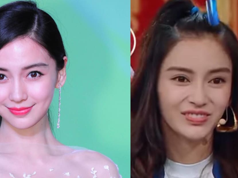 Angelababy shop plastic surgery