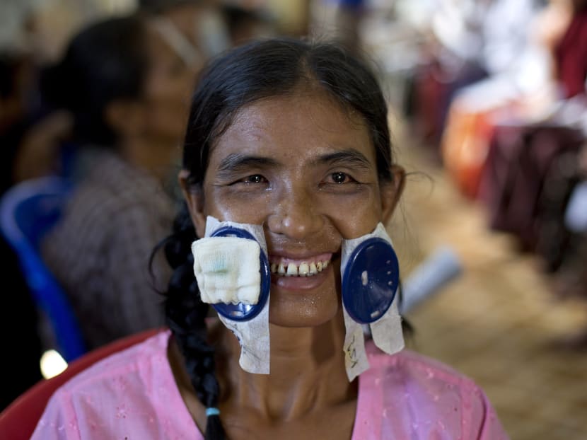 Veil of darkness lifts for Myanmar’s blind