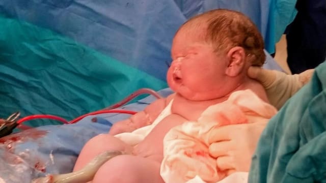 英国女子诞下近七公斤巨婴 亲友取名“河马宝宝”