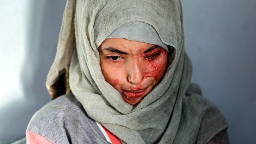 Ini wajah mangsa keganasan terhadap wanita di Yaman