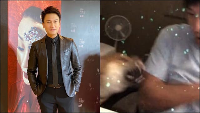 直播时被柴犬猛咬　王建复手臂见血！