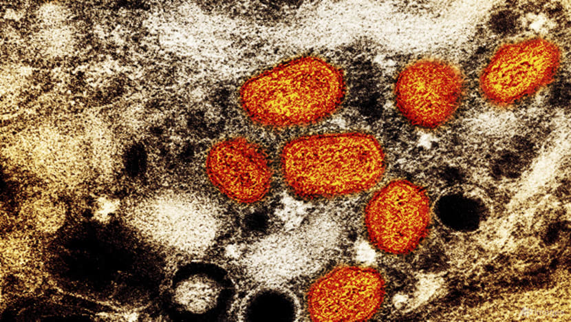 Advocacy groups caution against stigma in monkeypox messaging, say disease awareness should be for all Advocacy groups caution against stigma in monkeypox messaging, say disease awareness should be for all