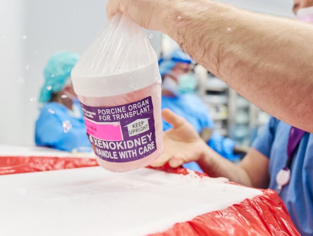 This image released by NYU Langone Health shows the gene-edited pig kidney being removed from its transport container, on April 12, 2024, in New York. A genetically modified pig kidney has been transplanted in the US for the second time into a living person.