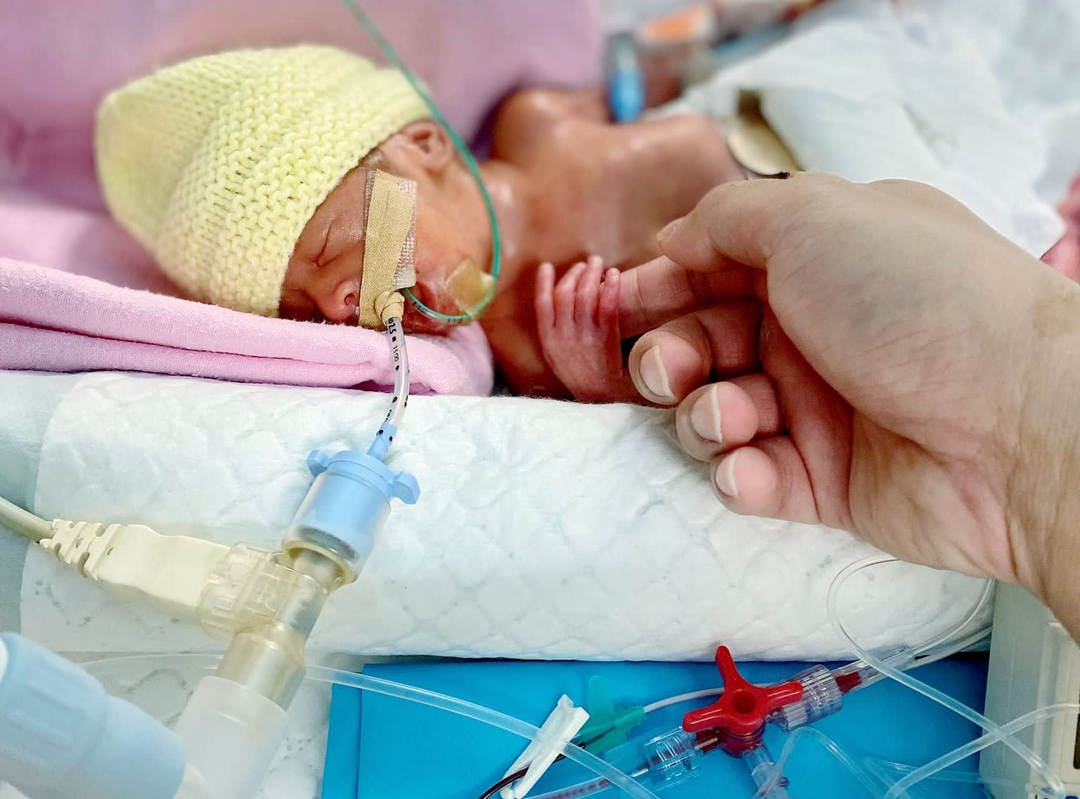 Premature baby ‘size of a palm’ home after 400 days in KKH, parents learn to rise above heartache 