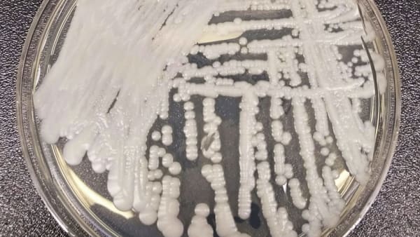 38 cases of Candida auris fungal infection reported to MOH since 2019