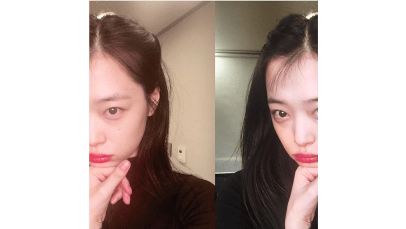 Sulli Reportedly Sent to ER After Sustaining Wrist Injury