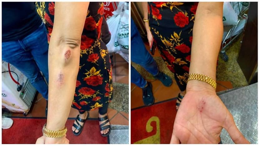 Police arrest man who allegedly used racial slurs, kicked woman in Choa Chu Kang