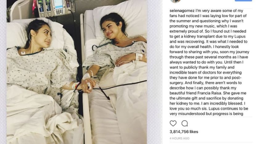 Selena Gomez jalani pemindahan ginjal akibat penyakit lupus