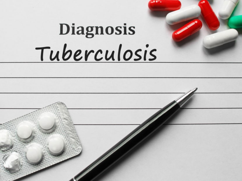 Singapore has seen an average of 1,510 new cases of tuberculosis each year from 2009 to 2018, data from the Ministry of Health showed.