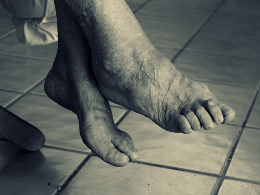 Court orders man to leave home, stop 'tormenting' 90-year-old mother with dementia; cites impact of caregiver stress Court orders man to leave home, stop 'tormenting' 90-year-old mother with dementia; cites impact of caregiver stress