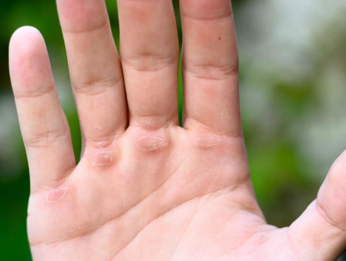 Do workouts make your hands and feet feel rough? Here's how to
