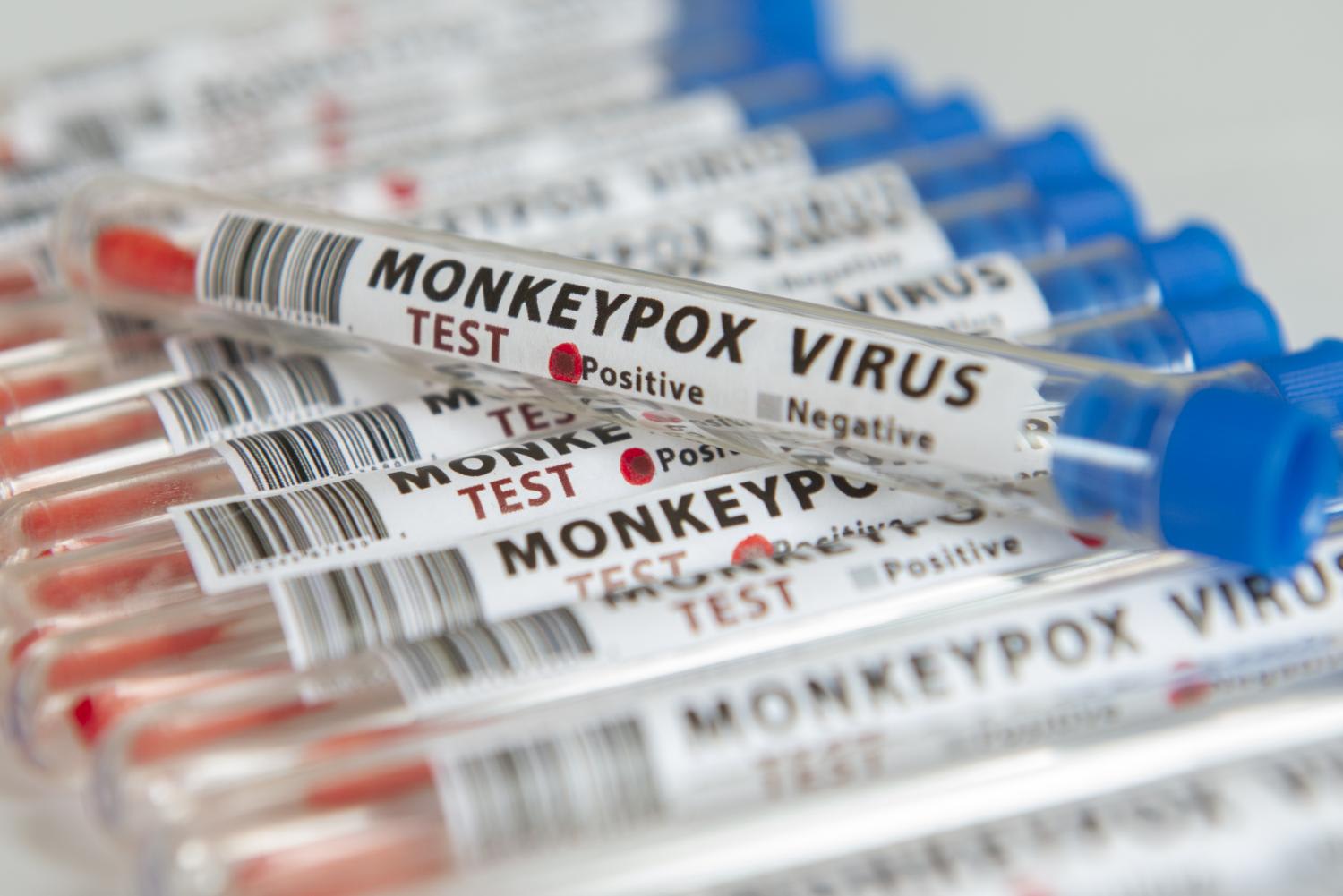 Monkeypox can cause symptoms such as fever, headaches, back pain, aching muscles and a general fatigue. Once the fever stops, a bumpy rash may develop on parts of the body. Monkeypox can cause symptoms such as fever, headaches, back pain, aching muscles and a general fatigue. Once the fever stops, a bumpy rash may develop on parts of the body.